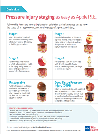 Illustrations of pressure injuries, various stages, on dark skin.